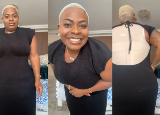 Jojo perdeu mais de 50 kg após uma cirurgia