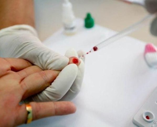 Sesab nega surto de HIV entre jovens na Bahia