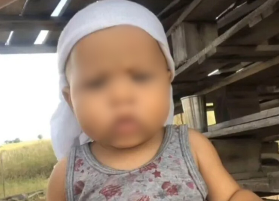 bebê é picado por cobra na bahia