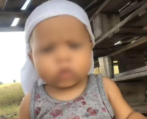 bebê é picado por cobra na bahia