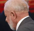 Lula passa por radioterapia preventiva após retirada de câncer